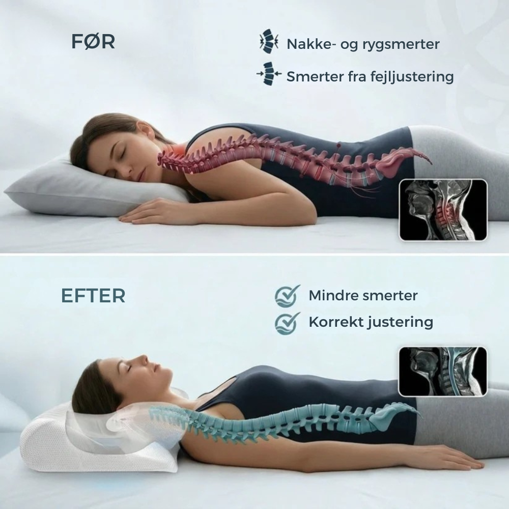 NordRo™ | Ge din nacke det stöd den har saknat varje natt