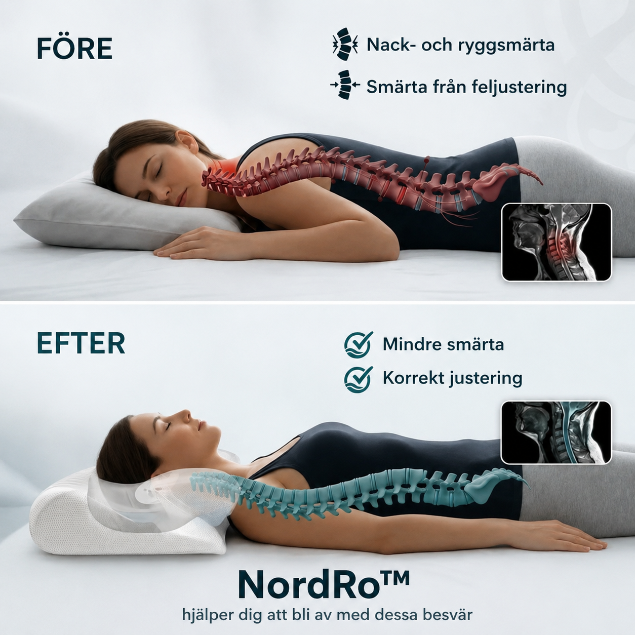 NordRo™ | Ge din nacke det stöd den har saknat varje natt